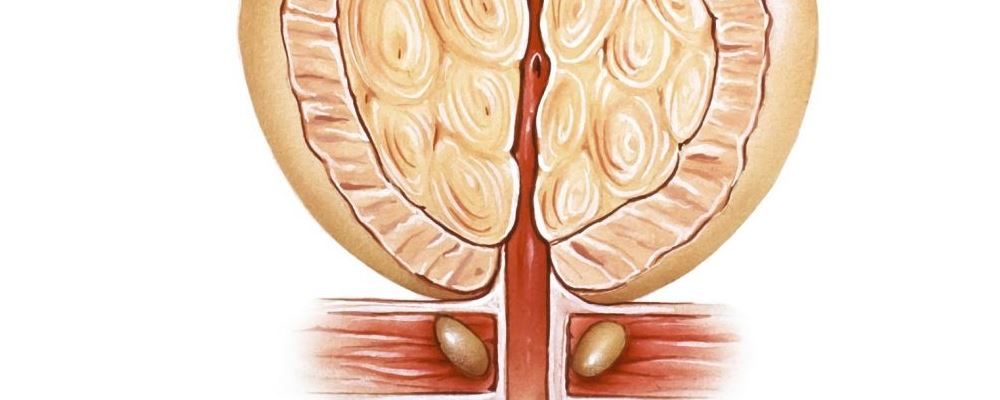 男性患上前列腺炎的5大病因 日常少做一些事